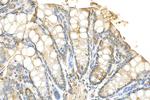 GPR112 Antibody in Immunohistochemistry (Paraffin) (IHC (P))