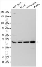 C3orf37 Antibody in Western Blot (WB)