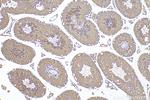 TTC9C Antibody in Immunohistochemistry (Paraffin) (IHC (P))