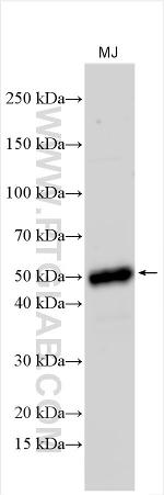 IL-23R Antibody in Western Blot (WB)