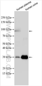 Alpha-1-microglobulin Antibody in Western Blot (WB)
