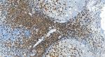 CD2 Antibody in Immunohistochemistry (Paraffin) (IHC (P))