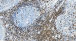 CD2 Antibody in Immunohistochemistry (Paraffin) (IHC (P))
