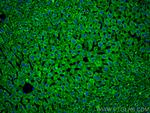 Serum amyloid P component Antibody in Immunohistochemistry (PFA fixed) (IHC (PFA))