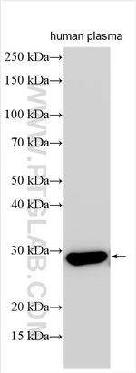 Serum amyloid P component Antibody in Western Blot (WB)