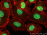 IK Antibody in Immunocytochemistry (ICC/IF)