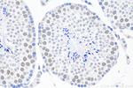 IK Antibody in Immunohistochemistry (Paraffin) (IHC (P))