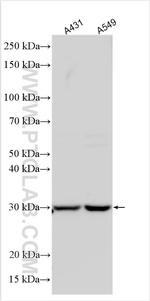 TATDN1 Antibody in Western Blot (WB)