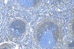 CD79a Antibody in Immunohistochemistry (Paraffin) (IHC (P))