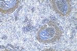 CD79a Antibody in Immunohistochemistry (Paraffin) (IHC (P))