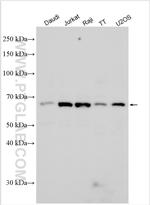 KCNA6 Antibody in Western Blot (WB)