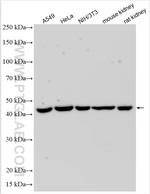 TRNT1 Antibody in Western Blot (WB)