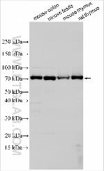 PABPC1L Antibody in Western Blot (WB)