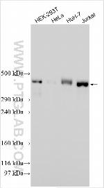 TMEM143 Antibody in Western Blot (WB)