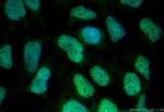 CHD7 Antibody in Immunocytochemistry (ICC/IF)