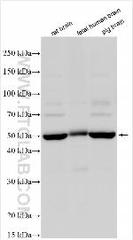 CHD7 Antibody in Western Blot (WB)
