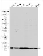 CCDC167 Antibody in Western Blot (WB)