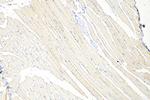 CLEC2L Antibody in Immunohistochemistry (Paraffin) (IHC (P))