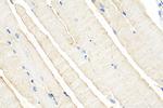 CLEC2L Antibody in Immunohistochemistry (Paraffin) (IHC (P))