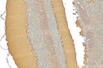 CLEC2L Antibody in Immunohistochemistry (Paraffin) (IHC (P))