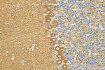 CLEC2L Antibody in Immunohistochemistry (Paraffin) (IHC (P))