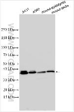 FCAMR Antibody in Western Blot (WB)