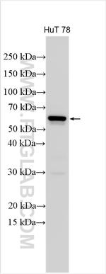 KIR2DL2 Antibody in Western Blot (WB)
