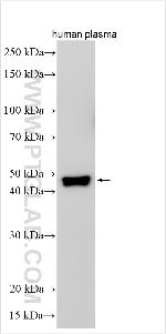 SPINT3 Antibody in Western Blot (WB)