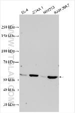 CPN1 Antibody in Western Blot (WB)
