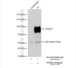 IFNGR1 Antibody in Immunoprecipitation (IP)
