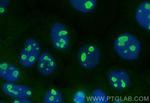 NOP16 Antibody in Immunocytochemistry (ICC/IF)