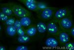 NOP16 Antibody in Immunocytochemistry (ICC/IF)