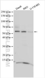KBTBD8 Antibody in Western Blot (WB)