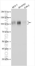 ZNF618 Antibody in Western Blot (WB)