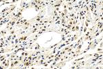 ANP32E Antibody in Immunohistochemistry (Paraffin) (IHC (P))