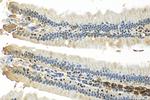 ANP32E Antibody in Immunohistochemistry (Paraffin) (IHC (P))