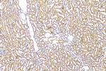 ANP32E Antibody in Immunohistochemistry (Paraffin) (IHC (P))