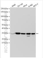 ANP32E Antibody in Western Blot (WB)