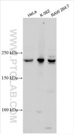 DOCK11 Antibody in Western Blot (WB)