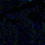 Acetyl-alpha Tubulin (Lys40) Antibody in Immunocytochemistry (ICC/IF)