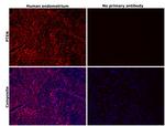 PTEN Antibody in Immunohistochemistry (Paraffin) (IHC (P))