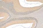 HECW2 Antibody in Immunohistochemistry (Paraffin) (IHC (P))
