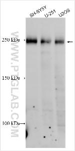 KIAA0196 Antibody in Western Blot (WB)