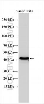 TCF20 Antibody in Western Blot (WB)
