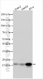 RSPH1 Antibody in Western Blot (WB)