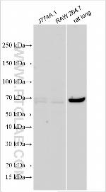 IL-17RA Antibody in Western Blot (WB)