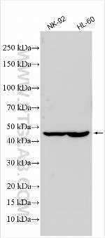 CSF2RA/CD116 Antibody in Western Blot (WB)