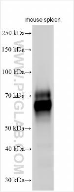 CD64 Antibody in Western Blot (WB)