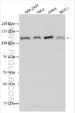 FBXO16 Antibody in Western Blot (WB)