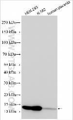 SLC66A2 Antibody in Western Blot (WB)